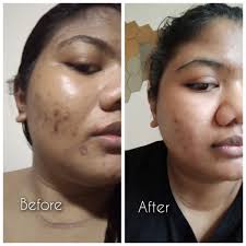 The Ordinary – Hyaluronic Acid 2% + B5